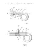 METHODS AND DEVICES FOR DIASTOLIC ASSIST diagram and image