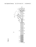 BONE TREATMENT SYSTEM diagram and image