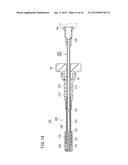 BONE TREATMENT SYSTEM diagram and image