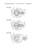 BONE TREATMENT SYSTEM diagram and image