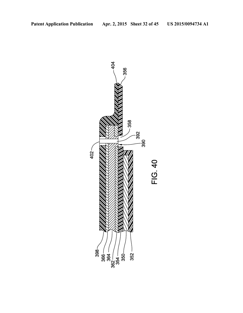 ELECTRODE ARRAY AND DEPLOYMENT ASSEMBLY INCLUDING AN ELECTRODE ARRAY THAT     IS FOLDED INTO A CANNULA THAT IS NARROWER IN WIDTH THAN THE ARRAY - diagram, schematic, and image 33