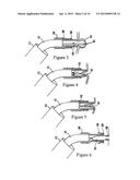 DEVICES AND METHODS FOR SECURING TISSUE diagram and image