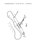 ATHERECTOMY DEVICE WITH ECCENTRIC CROWN diagram and image