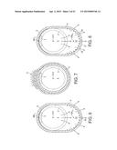 Rotational Atherectomy Device with Fluid Inflatable Support Elements and     Distal Protection Capability diagram and image