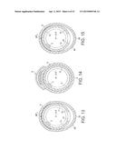 Rotational Atherectomy Device with Fluid Inflatable Support Elements and     Distal Protection Capability diagram and image