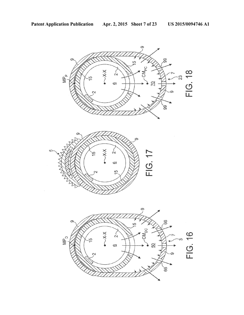 Rotational Atherectomy Device with Fluid Inflatable Support Elements and     Distal Protection Capability - diagram, schematic, and image 08