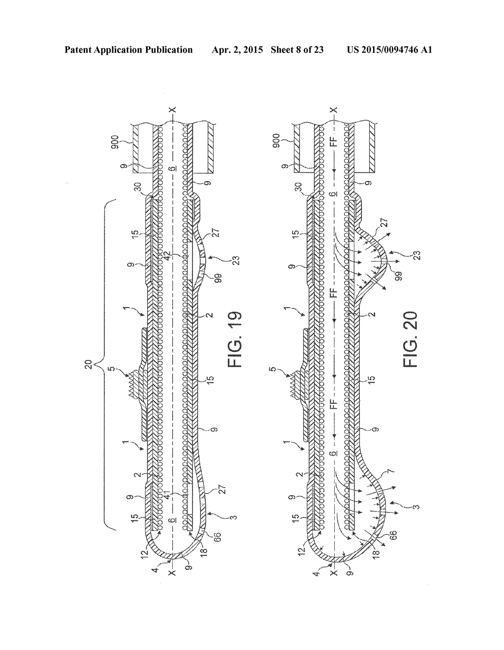 Rotational Atherectomy Device with Fluid Inflatable Support Elements and     Distal Protection Capability - diagram, schematic, and image 09