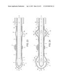 Rotational Atherectomy Device with Fluid Inflatable Support Elements and     Distal Protection Capability diagram and image