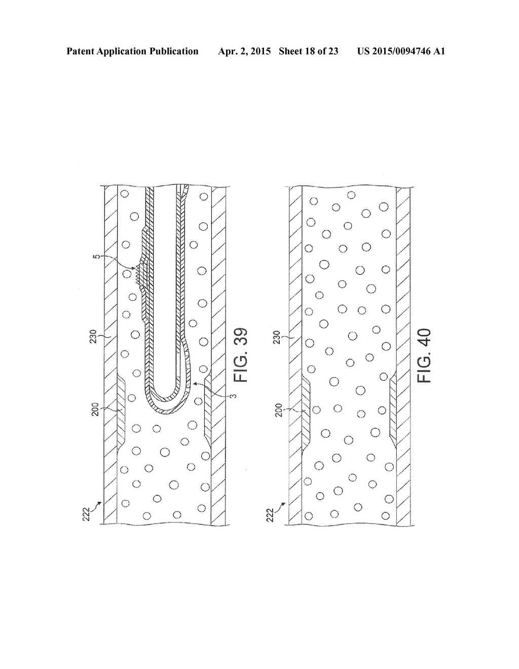 Rotational Atherectomy Device with Fluid Inflatable Support Elements and     Distal Protection Capability - diagram, schematic, and image 19