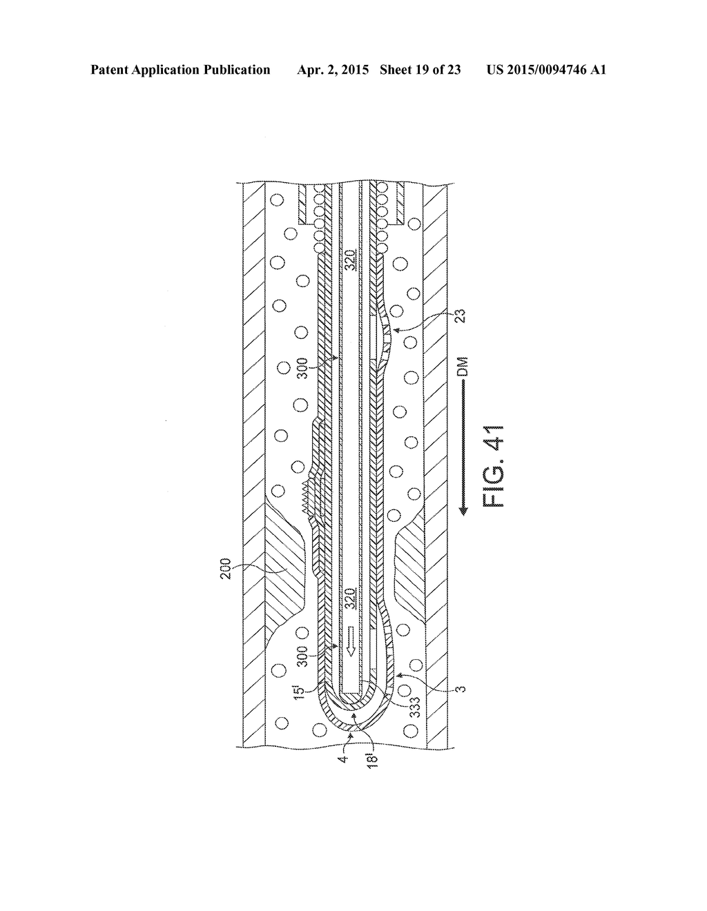 Rotational Atherectomy Device with Fluid Inflatable Support Elements and     Distal Protection Capability - diagram, schematic, and image 20