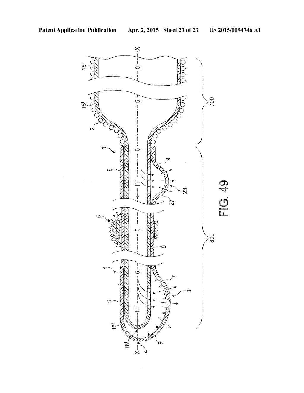 Rotational Atherectomy Device with Fluid Inflatable Support Elements and     Distal Protection Capability - diagram, schematic, and image 24