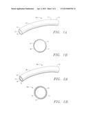 Reinforced Vascular Prostheses diagram and image