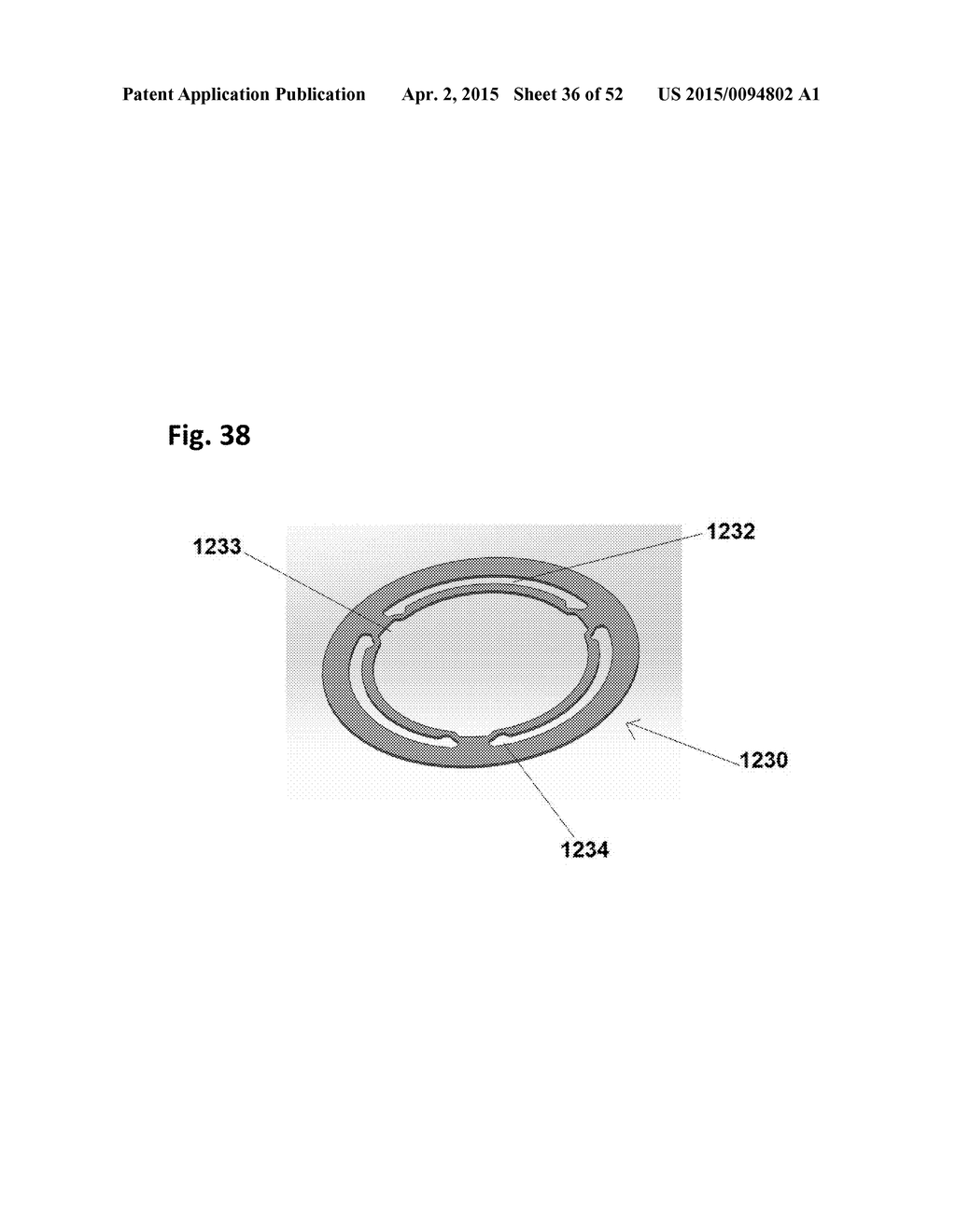 SINGLE-RING CARDIAC VALVE SUPPORT - diagram, schematic, and image 37