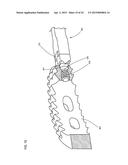 SPINAL IMPLANTS AND RELATED INSTRUMENTS AND METHODS diagram and image