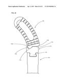 SPINAL IMPLANTS AND RELATED INSTRUMENTS AND METHODS diagram and image