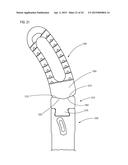 SPINAL IMPLANTS AND RELATED INSTRUMENTS AND METHODS diagram and image