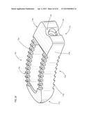SPINAL IMPLANTS AND RELATED INSTRUMENTS AND METHODS diagram and image