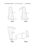 PROSTHESIS SOCKET, METHOD FOR MAKING SUCH A SOCKET diagram and image