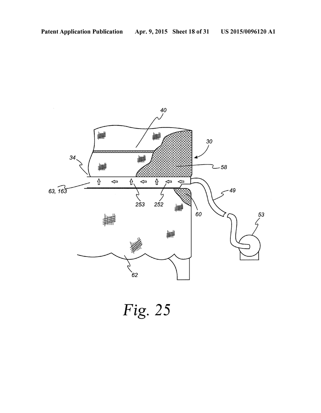 Active Mattress Encasement - diagram, schematic, and image 19