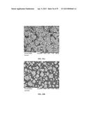 METHODS AND COMPOSITIONS USING CALCIUM CARBONATE diagram and image