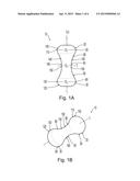 PESSARY DEVICE diagram and image