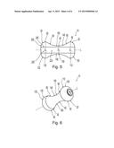 PESSARY DEVICE diagram and image