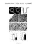 Modulators of ACYL-COA Lysocardiolipin Acyltransferase 1 (ALCAT1) and Uses     Thereof diagram and image