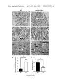 Modulators of ACYL-COA Lysocardiolipin Acyltransferase 1 (ALCAT1) and Uses     Thereof diagram and image