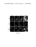 Modulators of ACYL-COA Lysocardiolipin Acyltransferase 1 (ALCAT1) and Uses     Thereof diagram and image