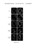 Modulators of ACYL-COA Lysocardiolipin Acyltransferase 1 (ALCAT1) and Uses     Thereof diagram and image