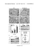 Modulators of ACYL-COA Lysocardiolipin Acyltransferase 1 (ALCAT1) and Uses     Thereof diagram and image