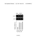 Modulators of ACYL-COA Lysocardiolipin Acyltransferase 1 (ALCAT1) and Uses     Thereof diagram and image