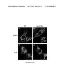 Modulators of ACYL-COA Lysocardiolipin Acyltransferase 1 (ALCAT1) and Uses     Thereof diagram and image