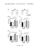 Modulators of ACYL-COA Lysocardiolipin Acyltransferase 1 (ALCAT1) and Uses     Thereof diagram and image