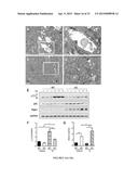 Modulators of ACYL-COA Lysocardiolipin Acyltransferase 1 (ALCAT1) and Uses     Thereof diagram and image