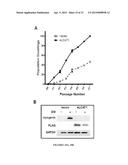 Modulators of ACYL-COA Lysocardiolipin Acyltransferase 1 (ALCAT1) and Uses     Thereof diagram and image