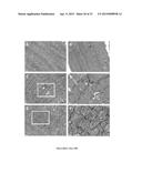 Modulators of ACYL-COA Lysocardiolipin Acyltransferase 1 (ALCAT1) and Uses     Thereof diagram and image