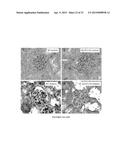 Modulators of ACYL-COA Lysocardiolipin Acyltransferase 1 (ALCAT1) and Uses     Thereof diagram and image