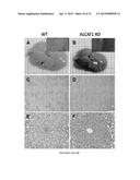 Modulators of ACYL-COA Lysocardiolipin Acyltransferase 1 (ALCAT1) and Uses     Thereof diagram and image