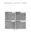 Modulators of ACYL-COA Lysocardiolipin Acyltransferase 1 (ALCAT1) and Uses     Thereof diagram and image