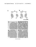 Modulators of ACYL-COA Lysocardiolipin Acyltransferase 1 (ALCAT1) and Uses     Thereof diagram and image