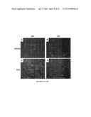 Modulators of ACYL-COA Lysocardiolipin Acyltransferase 1 (ALCAT1) and Uses     Thereof diagram and image