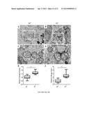 Modulators of ACYL-COA Lysocardiolipin Acyltransferase 1 (ALCAT1) and Uses     Thereof diagram and image