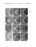 NANOLITHOGRAPHY USING LIGHT SCATTERING FROM PARTICLES AND ITS APPLICATIONS     IN CONTROLLED MATERIAL RELEASE diagram and image