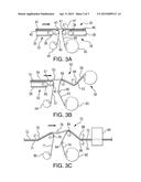 PREPREG TAPE SLITTING METHOD AND APPARATUS diagram and image