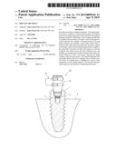 Implant Abutment diagram and image