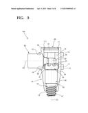 Implant Abutment diagram and image