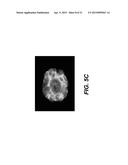 Immortalization of Epithelial Cells and Methods of Use diagram and image