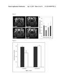 VARIANTS OF YEAST NDI1 GENE, AND USES THEREOF IN THE TREATMENT OF DISEASE     ASSOCIATED WITH MITOCHONDRIAL DYSFUNCTION diagram and image