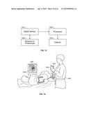 Endoscope with Integrated Sensors diagram and image